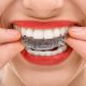 amil dental clareamento